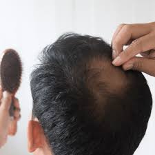Mesotherapy